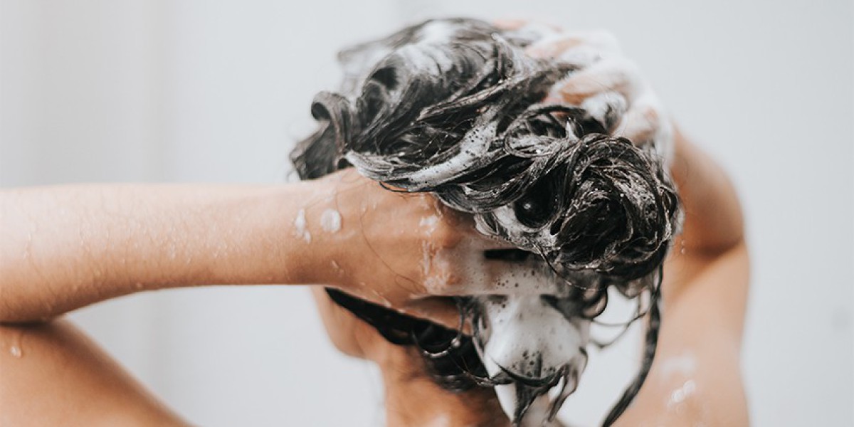 Shampoo with Zinc for Dandruff Control & Healthy Scalp in Pakistan