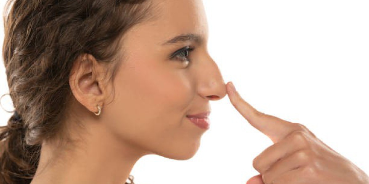 Rhinoplasty Procedure for Enhancing Profile Definition